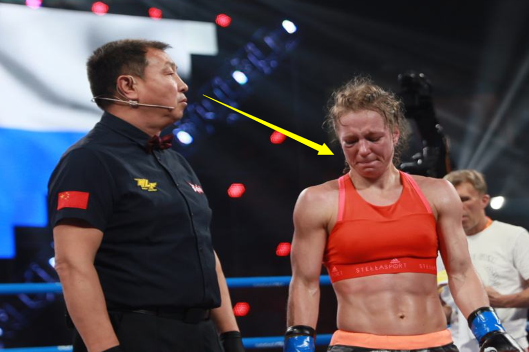 1xBit体育竞技-关于加蓬拳击选手面对强敌顽强作战的信息